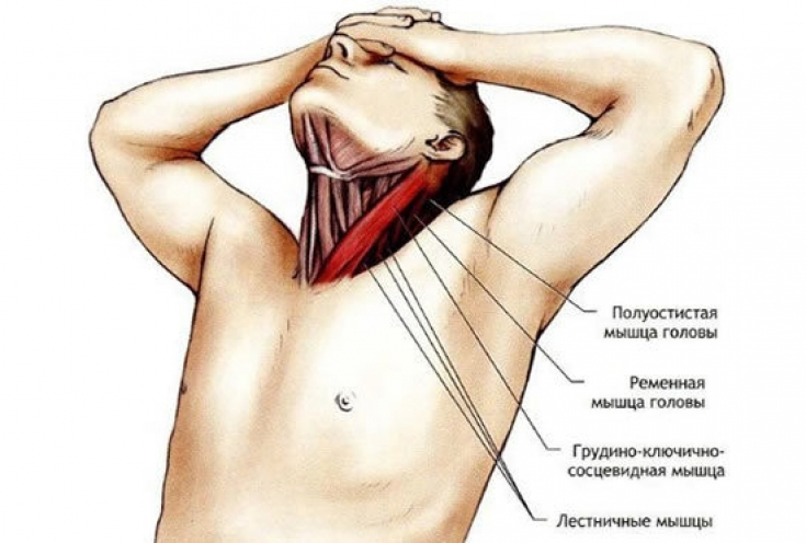 Растяжение мышц шеи — боль знакомая каждому